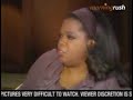 woman attacked by chimp shows face on oprah winfrey show