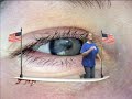 campbetterdays green screen videojohn video john mcnally loyal films guy loyalfilmsguy