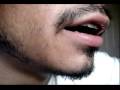 videos de The Acne Practice  (2008 Home Version Contest Winner!)