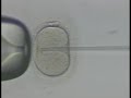 ICSI ICSI