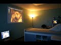Ultimate Ultrasound at Fetal Vision