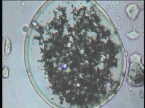 how to eliminate pyrogens