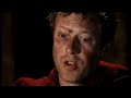Battle of Hastings (Part 6/6) Battle of Hastings (Part 6/6)