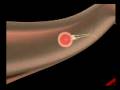 videos de PILULA CONTRACEPTIVA ESTE AVORTIVA!!!