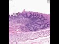 Shotgun Histology Gastro-Esophageal Junction
