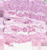 Shotgun Histology Gastro-Esophageal Junction