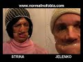 Normalnofobija - Medley 1