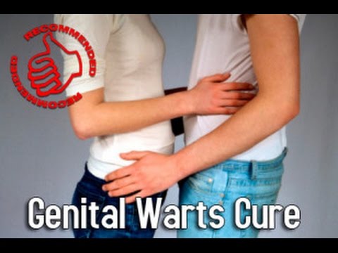 how to control warts