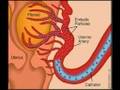 Ovarian Cysts home cures and remedies