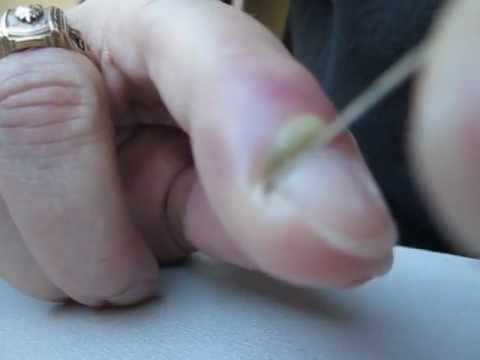 how to drain infected hangnail