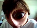 Jer - A BUG! Jer - A BUG!