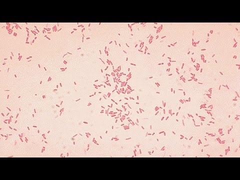 a study on necrotizing fasciitis or flesh eating disease a study on necrotizing fasciitis or flesh eating disease