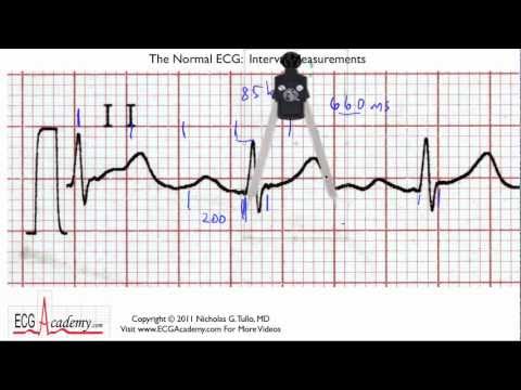 how to measure the p-r interval