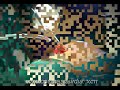 Cosmetic Surgery India - Dr.Surindher - Sub Fascial Breast Augmentation Cosmetic Surgery India - Dr.Surindher - Sub Fascial Breast Augmentation