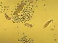 paramecium caudatum in conjugation