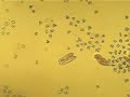 Paramecium caudatum in conjugation