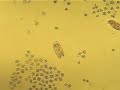 paramecium caudatum in conjugation