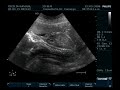 Ecografia 20 semanas Peredita!!!! Ecografia 20 semanas Peredita!!!!