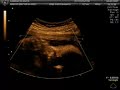 Ultrassom 4D - Henrique Basso Gon�alves Machado