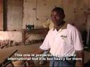 UMTV The Advance Prosthetic Program
