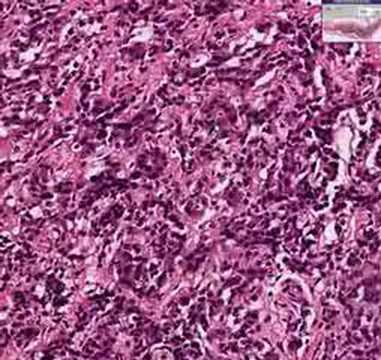Histopathology Adrenal ...
