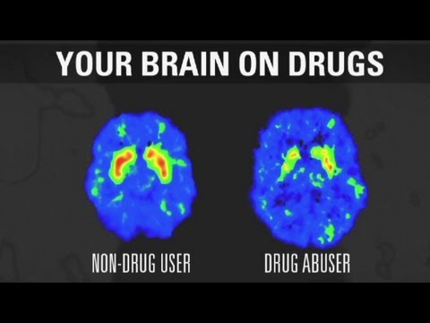 How addiction changes your brain