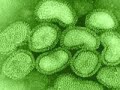 flu