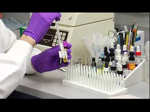 how to perform widal test