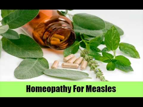 how to treat measles naturally