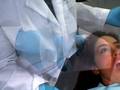 OptraGate Lip and Cheek Retractor