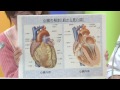 心臓と脳の異常