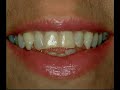 Odontologia Cosm�tica