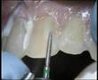 videos de Odontologia Cosmética
