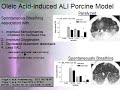Acute Respiratory Distress Syndrome