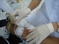 HEMODIALYSIS Insertion HEMODIALYSIS Insertion
