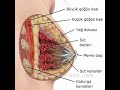 Silikon Ameliyatı Videosu, Op. Dr. Nazmi Bayçın