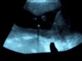 iker casillas a los 6 meses dentro de mama