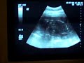 iker casillas a los 6 meses dentro de mama