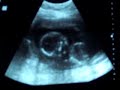 iker casillas a los 6 meses dentro de mama