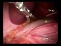 Cirurgia parte4