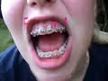 Thumbnail #1