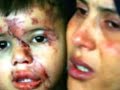 Massacre em Gaza