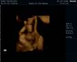 My son Travis 4D Ultrasound Video, 24 weeks