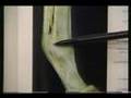 Horse Racing Fractures & Breakdowns - an in depth look 1993