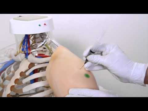 M155: Intramuscular Injection Model of Upper Arm Muscles