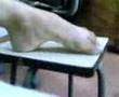 Asim high arched feet