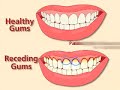 Sensitive Teeth (Video) Sensitive Teeth (Video)