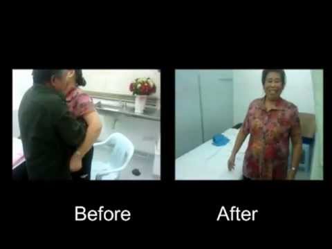how to cure slip disc