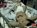Deformacja 2
