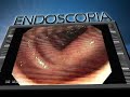 Endoscopia Gastrointestinal